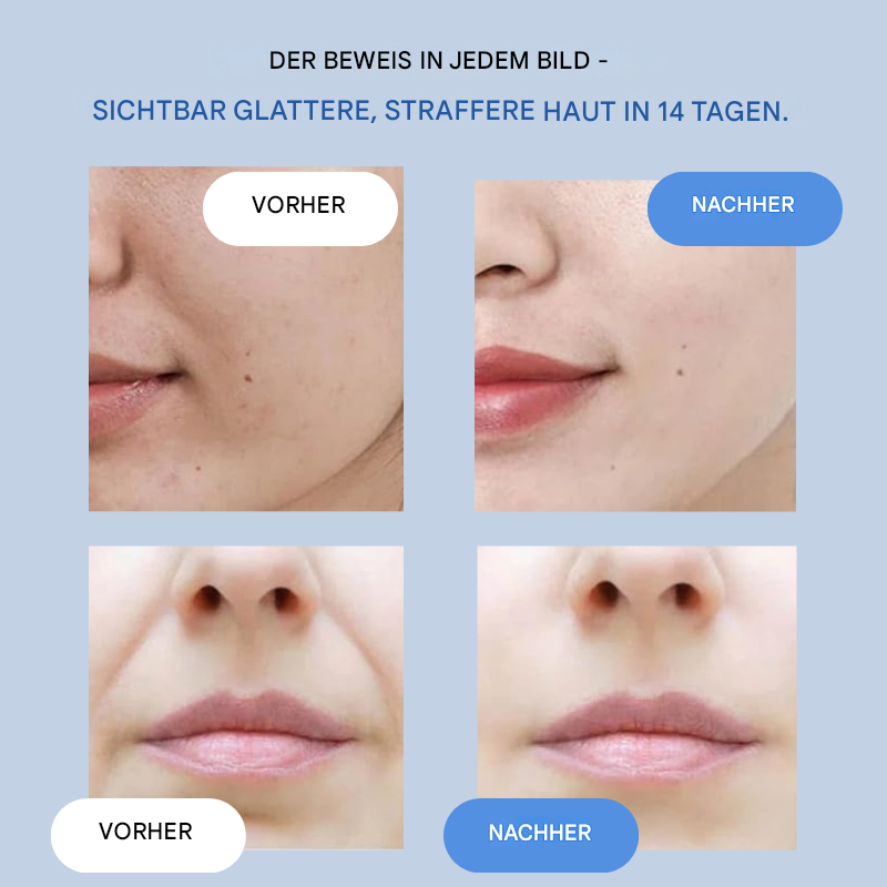 GlanzLift Skin-Tightening Face Strips — Instant Smoothing