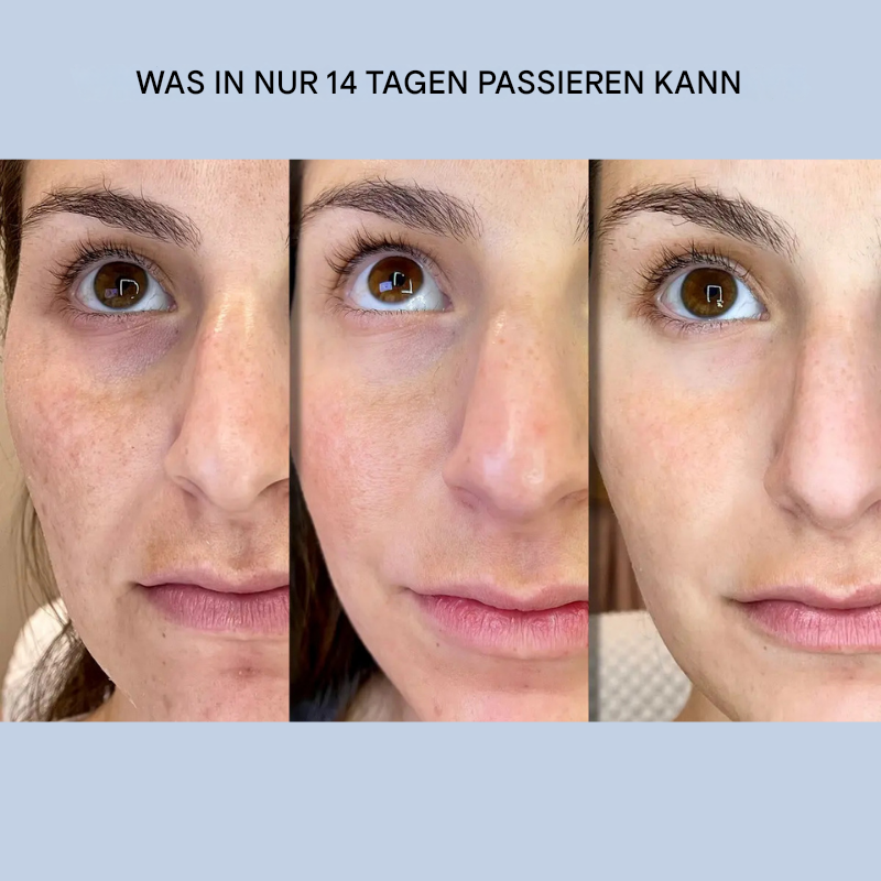 GlanzLift Skin-Tightening Face Strips — Instant Smoothing