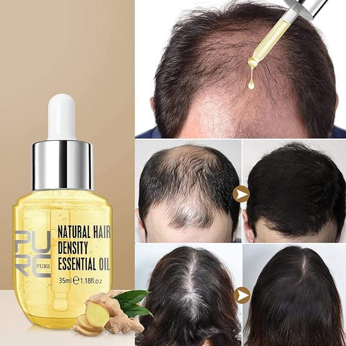 Hair Vitalizer® Natural Hair Growth Oil for Stronger, Shinier Hair