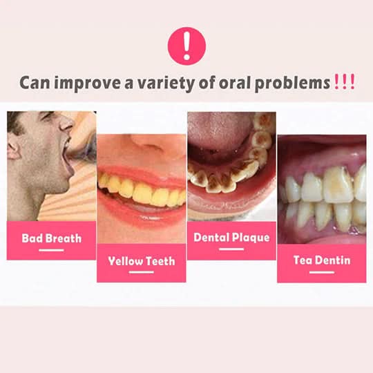 AeroSonic Detergente ultrasonico portatile per denti — Rimuovi tartaro con vibrazioni acustiche