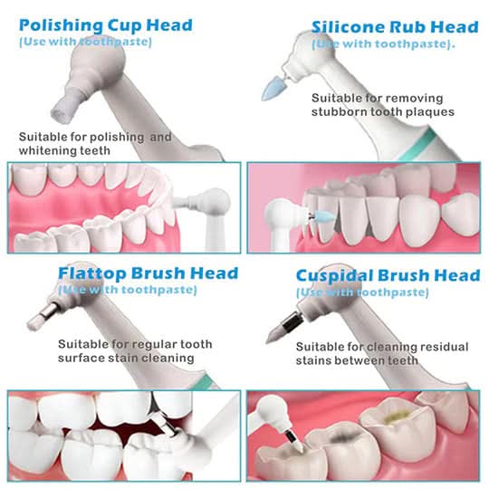 AeroSonic Detergente ultrasonico portatile per denti — Rimuovi tartaro con vibrazioni acustiche