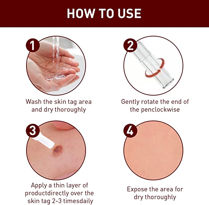 Herbal Wart Remover Precision Pen for Skin Blemishes