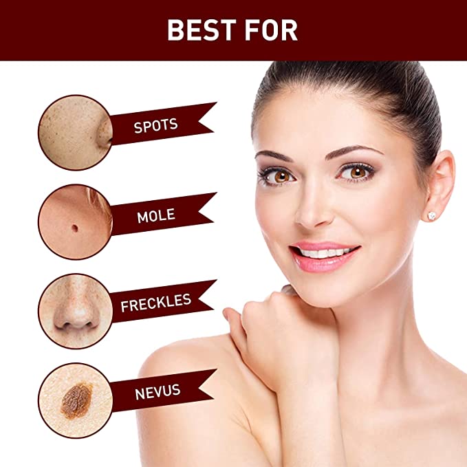 Herbal Wart Remover Precision Pen for Skin Blemishes