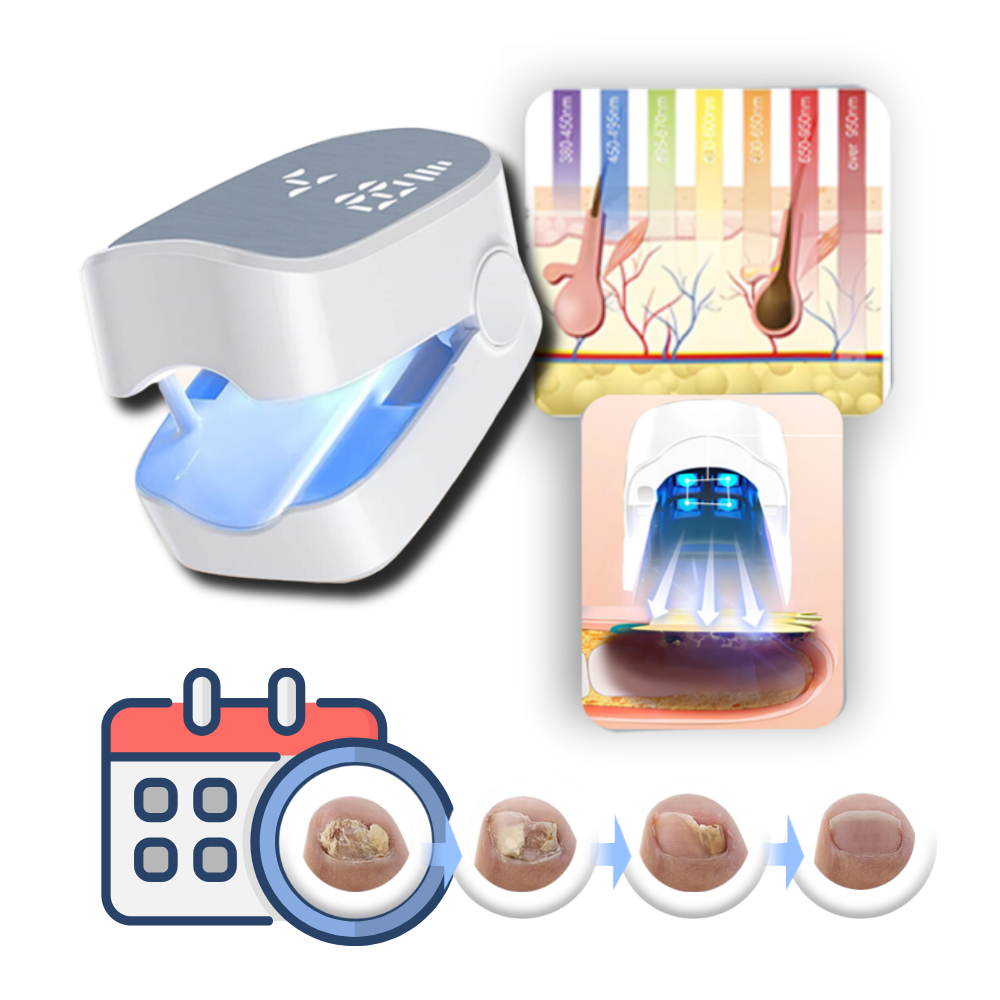 Painless Nail Fungus Laser | ventumra