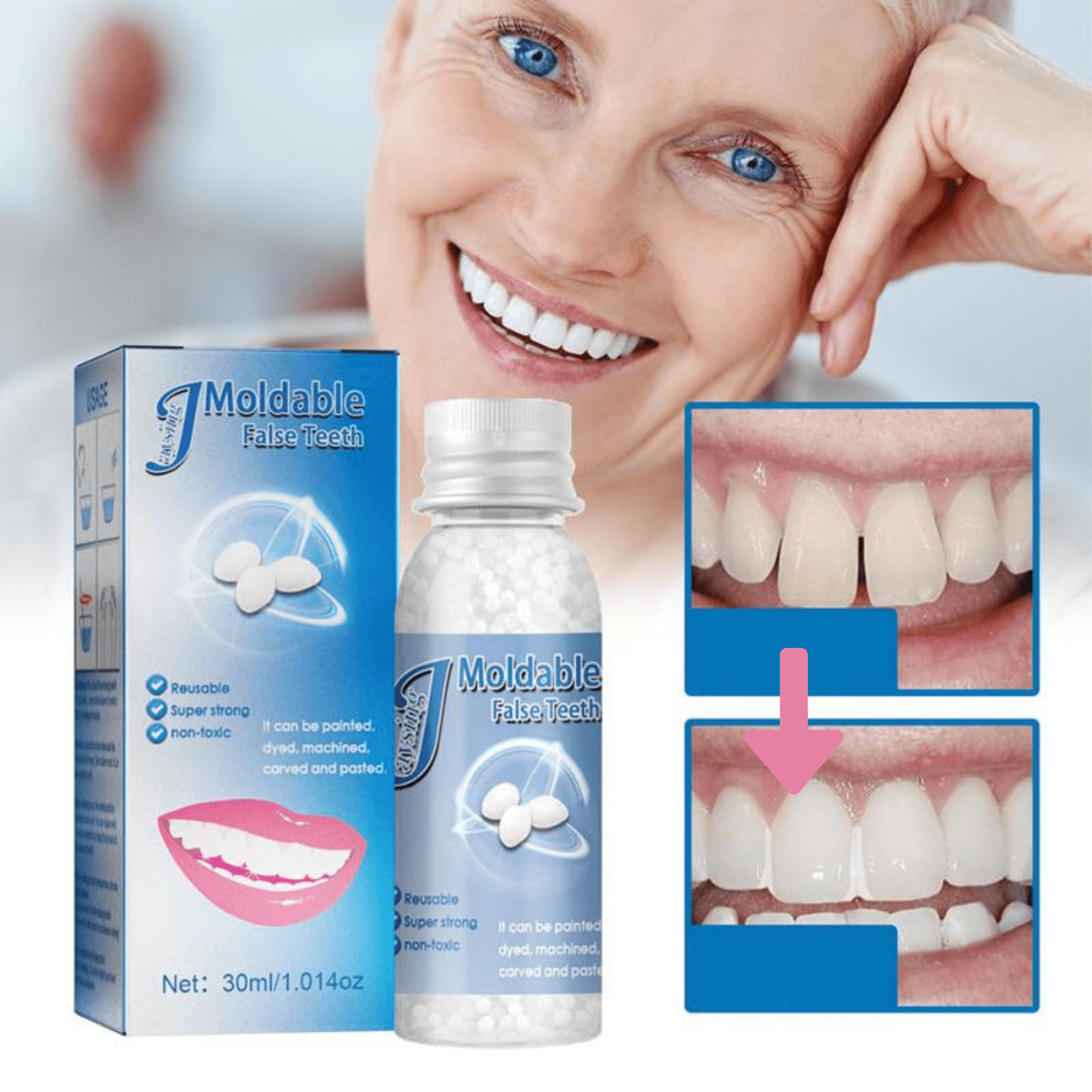 Temporary Tooth Filling Beads | ventumra