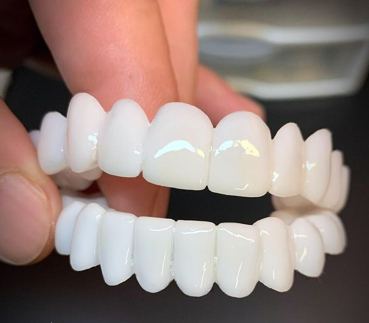 Natural-Look Tooth Replacement | ventumra