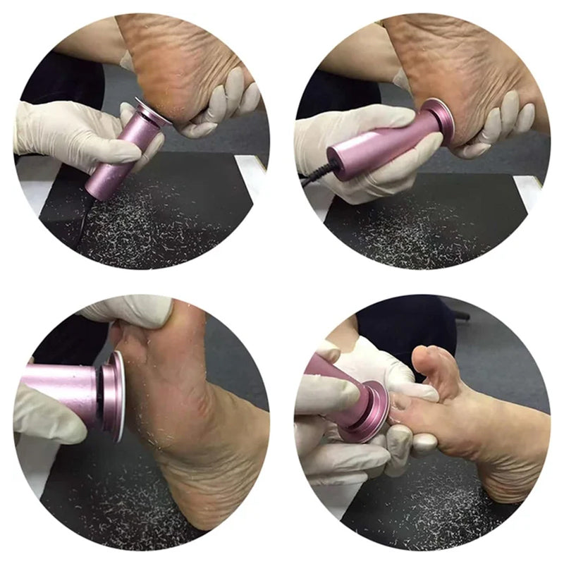 Electric Callus Remover for Soft Feet | ventumra