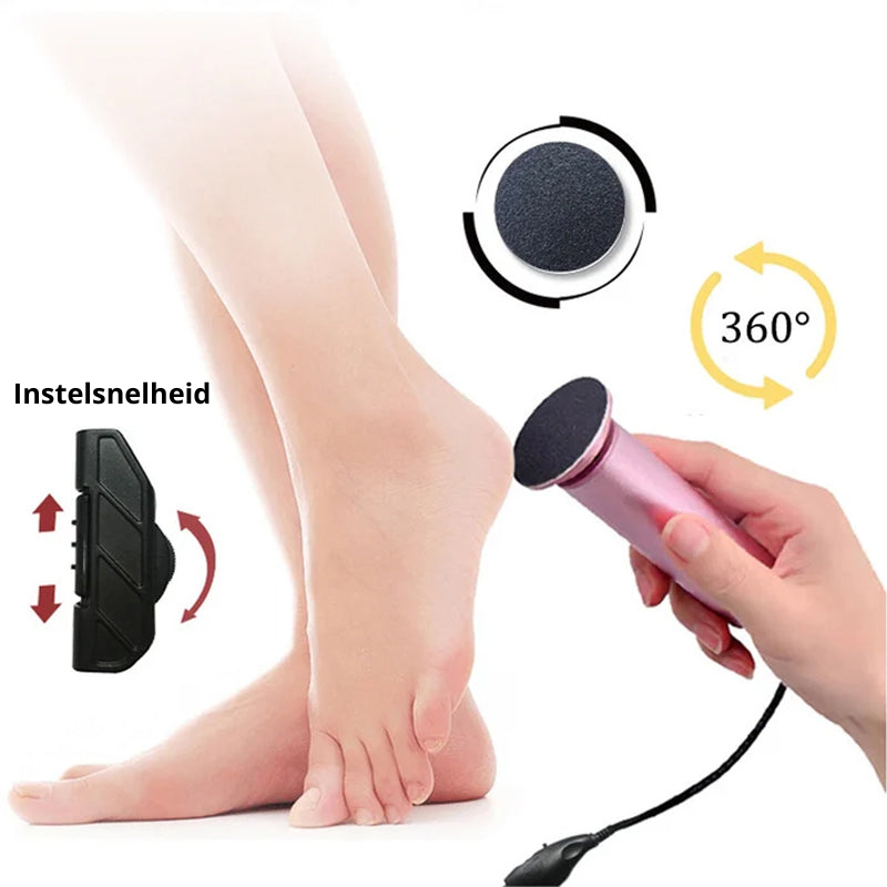 Electric Callus Remover for Soft Feet | ventumra
