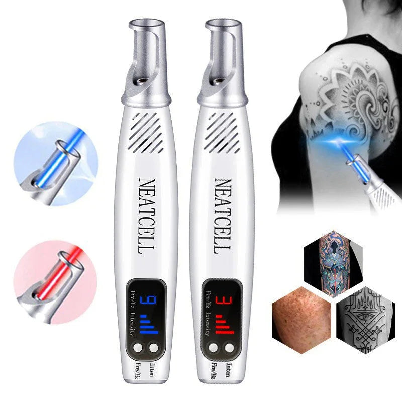 At-Home Laser Pen for Tattoo Pigment Modification | ventumra