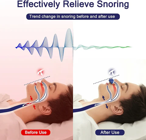 Maskless Nasal Airflow Device Sleep Comfort Aid | ventumra