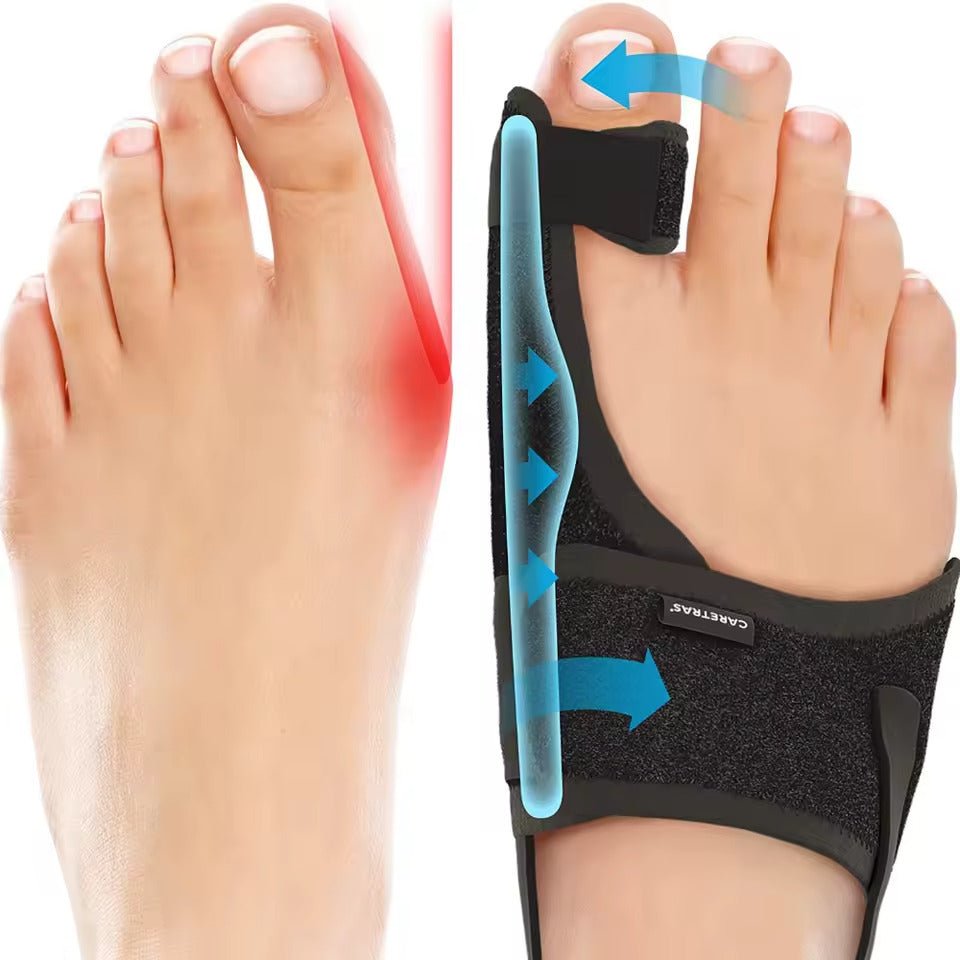 Night Splint Hallux Valgus - Ergonomic and Adjustable Comfort | ventumra