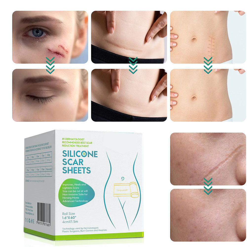 Silicone Scar Tape Roll for Appearance Management | ventumra