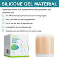 Silicone Scar Tape Roll for Appearance Management | ventumra