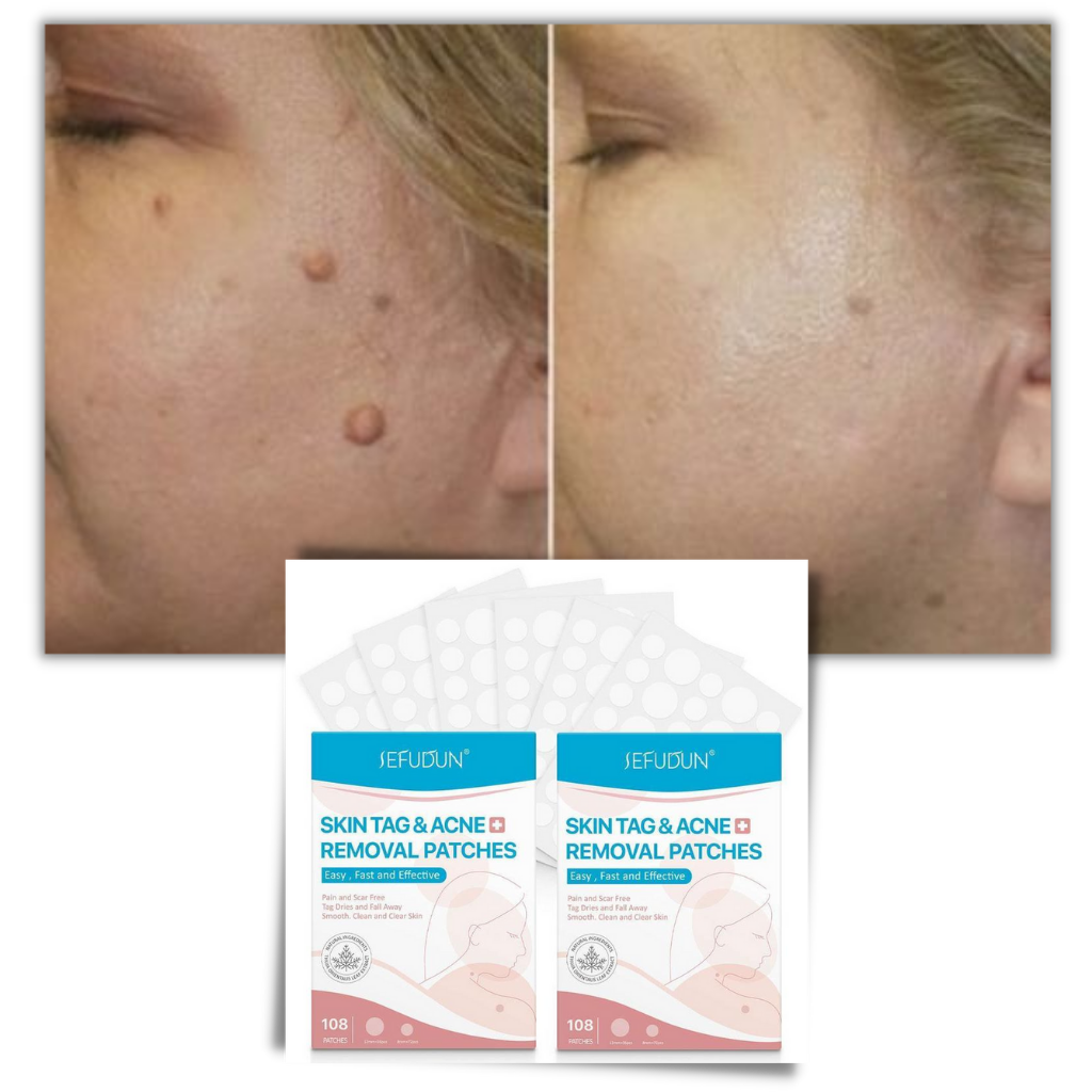 Cosmetic Skin Patches for Enhanced Skin Appearance | ventumra