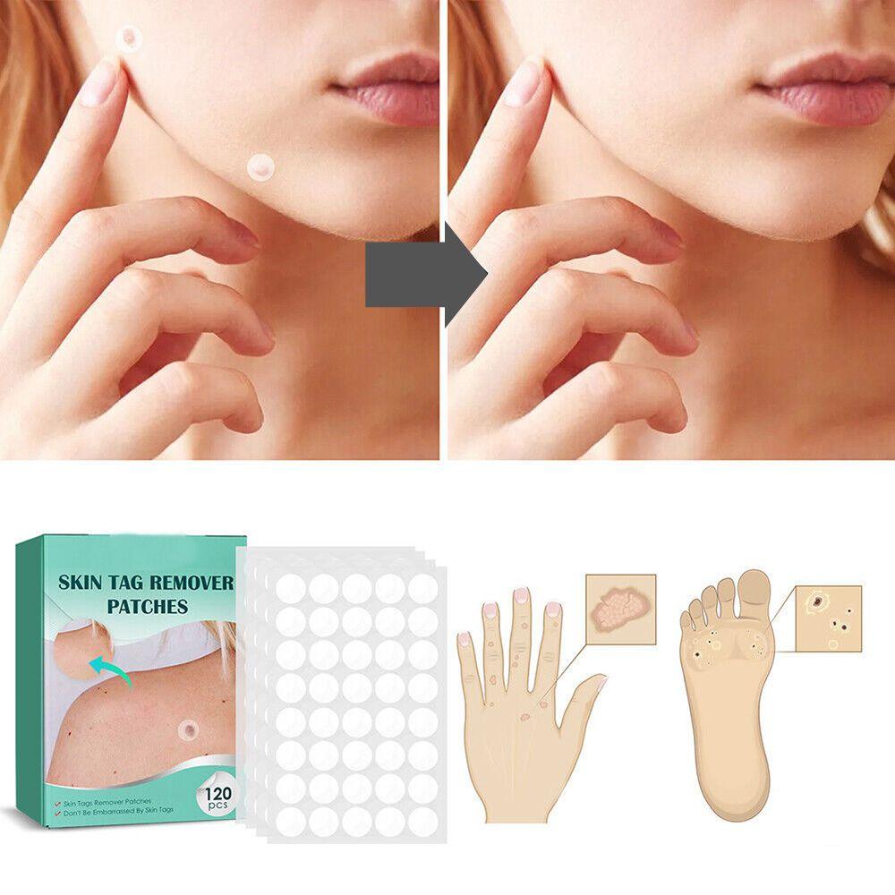 Hydrocolloid Patches for Minor Skin Imperfections - 120 Count | ventumra