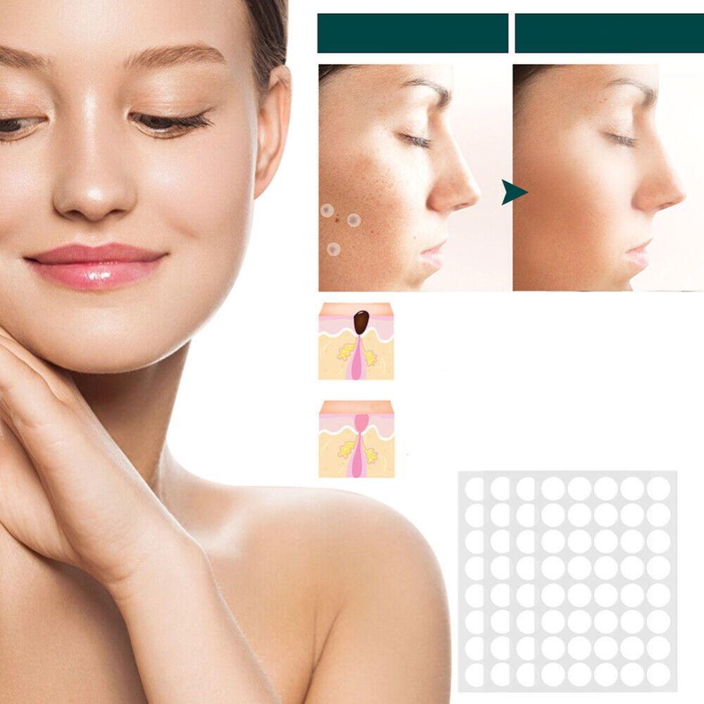 Hydrocolloid Patches for Minor Skin Imperfections - 120 Count | ventumra