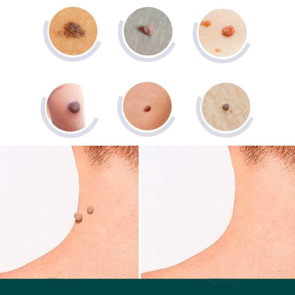 Hydrocolloid Patches for Minor Skin Imperfections - 120 Count | ventumra