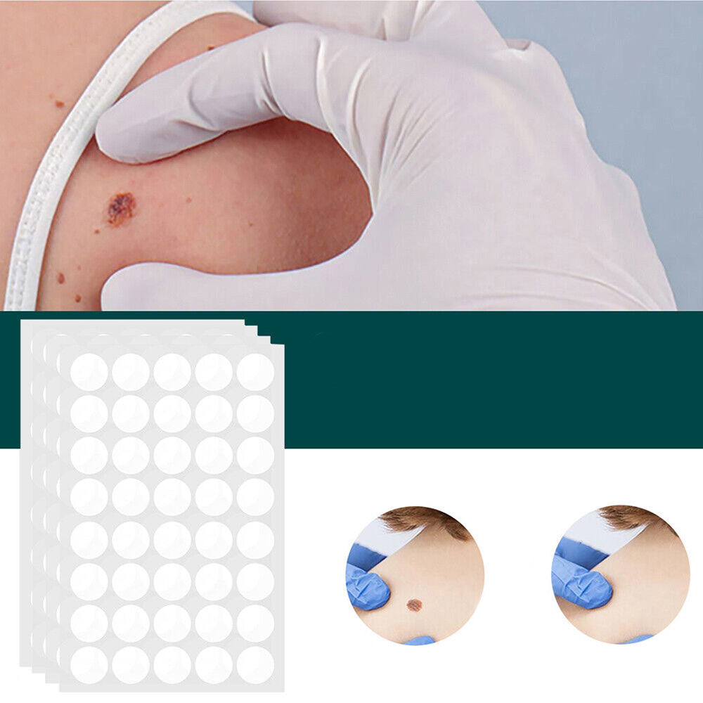 Hydrocolloid Patches for Minor Skin Imperfections - 120 Count | ventumra