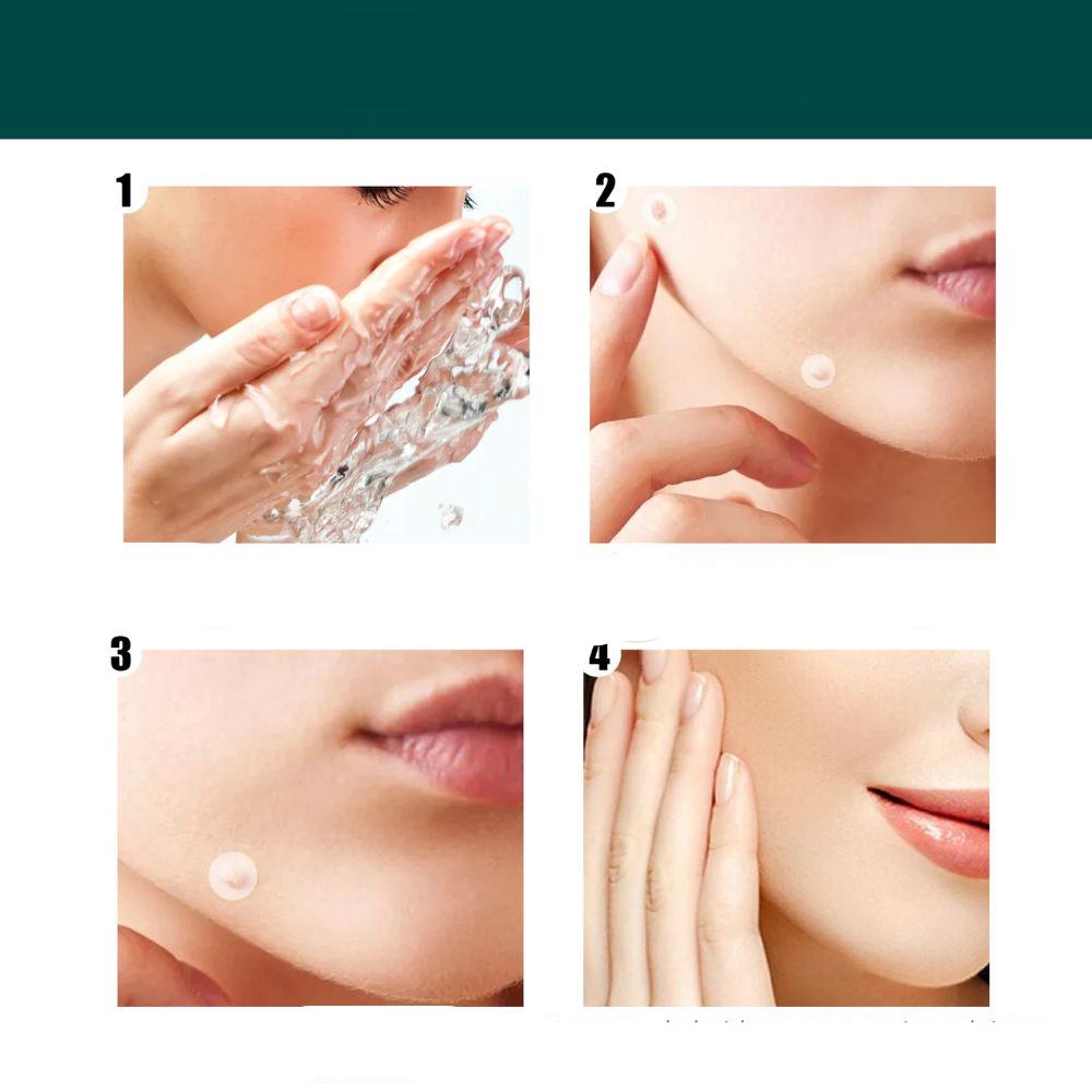 Hydrocolloid Patches for Minor Skin Imperfections - 120 Count | ventumra