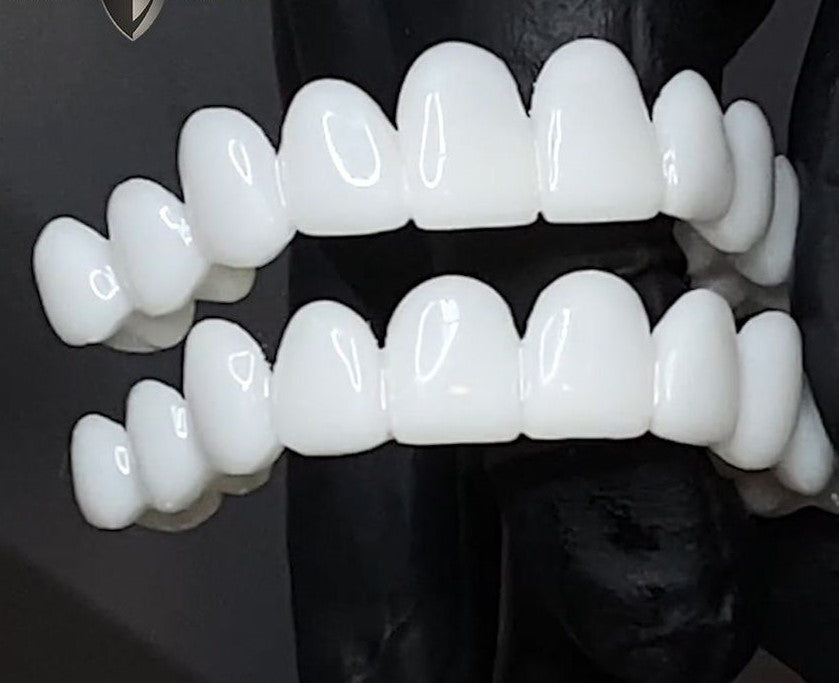 Aesthetic Dental Covers Instant Confidence | ventumra